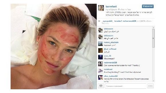 Bar Refaeli teste les injections de sang comme Kim Kardashian