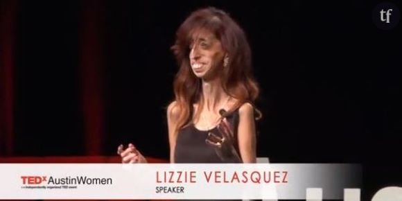 Lizzie Velasquez : la femme la plus moche du monde répond avec humour aux critiques