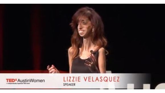 Lizzie Velasquez : la femme la plus moche du monde répond avec humour aux critiques