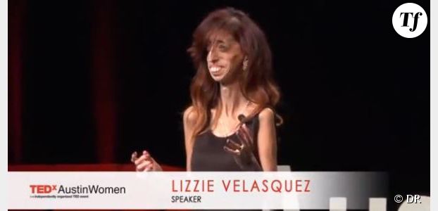 Lizzie Velasquez : la femme la plus moche du monde répond avec humour aux critiques