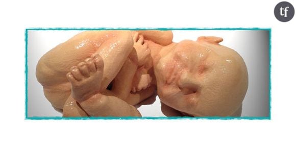 Imprimer votre foetus en 3D et grandeur nature à partir d'une échographie, ça vous tente ?