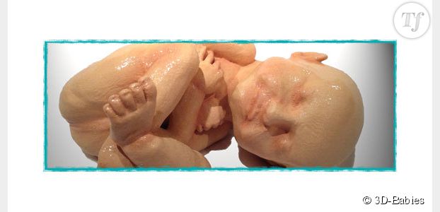 Imprimer votre foetus en 3D et grandeur nature à partir d'une échographie, ça vous tente ? 