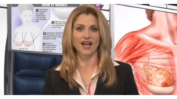 Chirurgie: un soutien-gorge permanent et invisible commercialisé