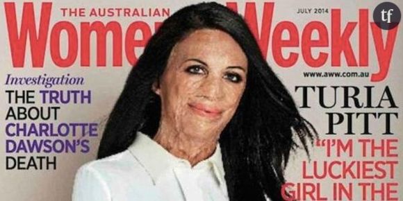 Un magazine féminin australien ose mettre une grande brûlée en couverture