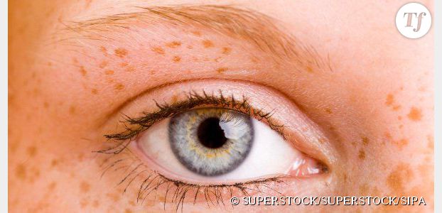 #Freckles : les (fausses) taches de rousseur, c'est tendance