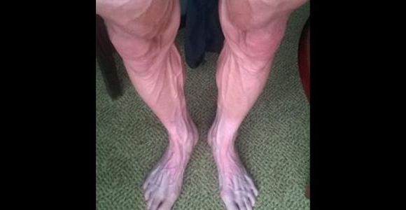 Tour de France : les jambes d’un coureur dans un sale état après une étape - photo