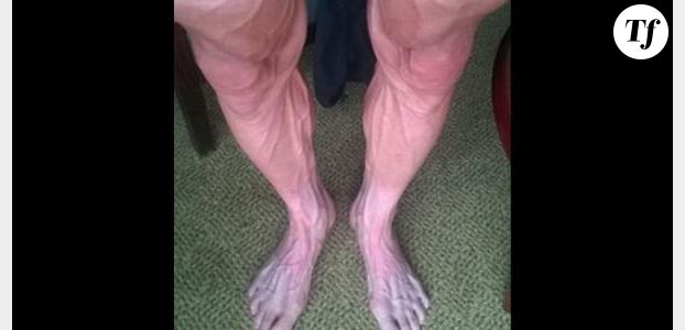 Tour de France : les jambes d’un coureur dans un sale état après une étape - photo