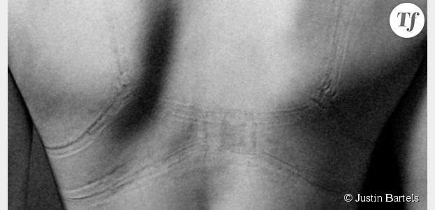 Ce photographe capture les effets des vêtements trop serrés sur le corps des femmes