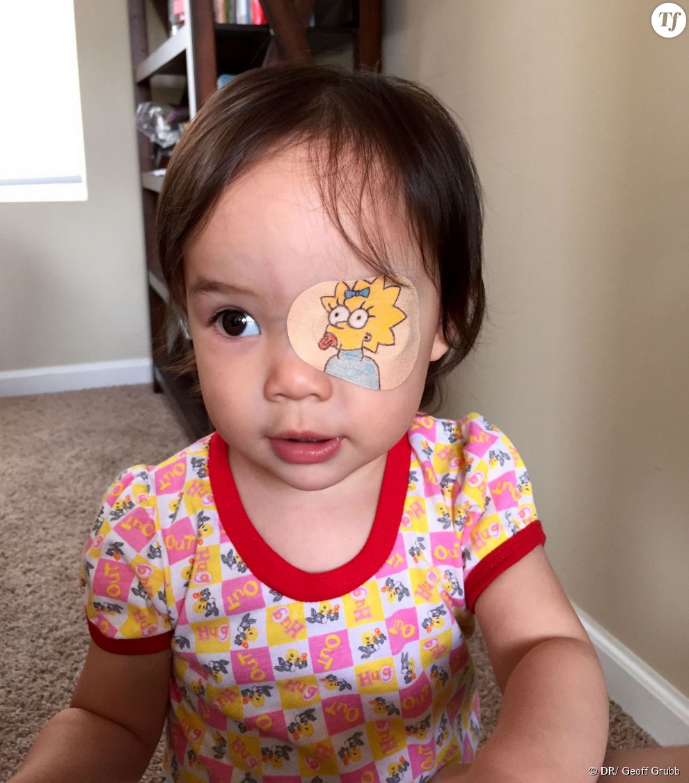 Eye daughter. Ребенок с повязкой на глазах. Заклейка для глаза ребенку. Наклейки на глаза детские. Повязка на глаз детская.