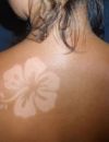 Le "Sunburn Art" consiste à laisser une marque de bronzage en forme de tatouage sur la peau.