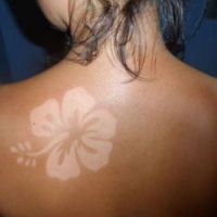 #SunBurnArt : le tatouage idiot à base de coup de soleil