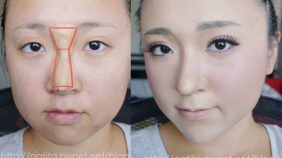 Envie de changer de nez ? La recette hallucinante pour se faire une rhinoplastie maison