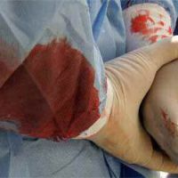 Les hôpitaux syriens, instruments de la répression selon Amnesty