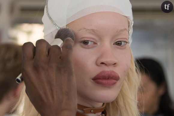 Diandra Forrest, premier mannequin albinos à devenir égérie