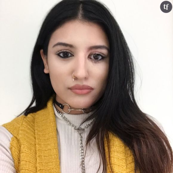 Victime d'une attaque à l'acide, elle poste un selfie de sa guérison sur Instagram