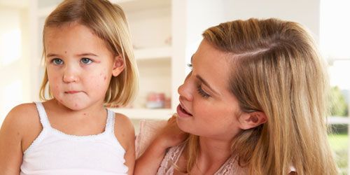 Rougeole : le mécanisme de contagion enfin découvert