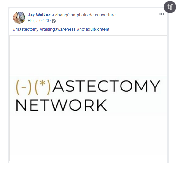 Masectomy Network