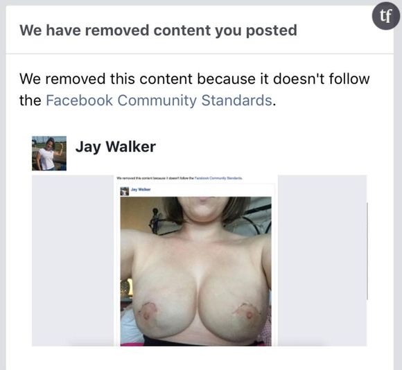 La notification de suppression de la cicatrice de Jay Walker par Facebook
