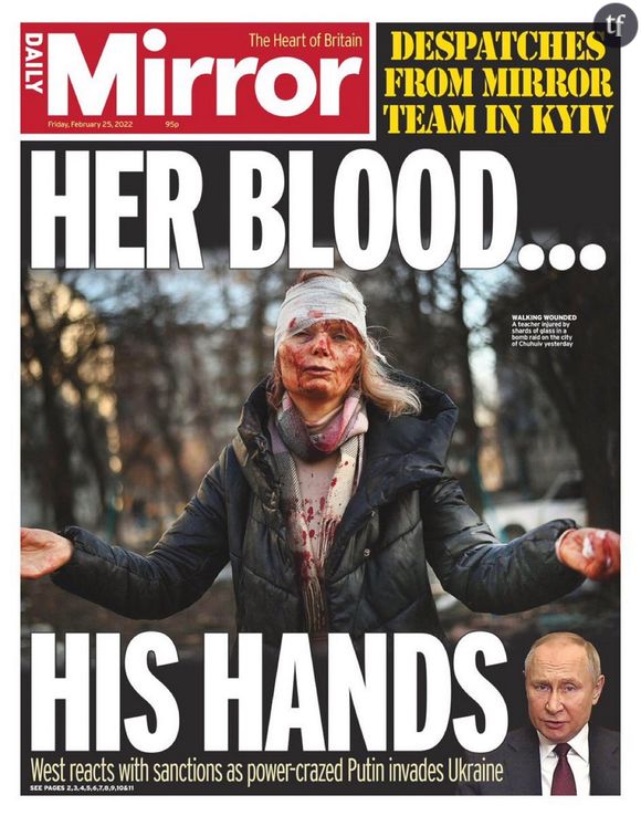 Olena Kurilo, le visage en sang, devient le symbole de l'enfer de la guerre en Ukraine