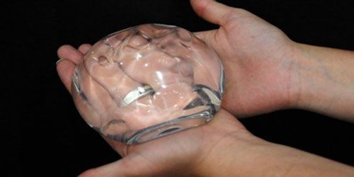 Prothèses mammaires PIP : les victimes manifestent à Paris