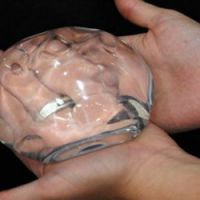 2,5 kilos de cocaïne dans ses implants mammaires