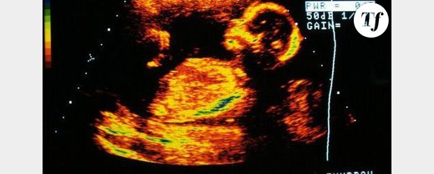 Canada : garder le sexe du bébé secret pour éviter l’avortement ?