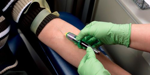 Cancer de la prostate : le dépistage systématique serait dangereux