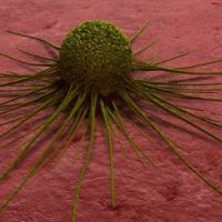Cancer : augmentation des cas de 75% d'ici 2030