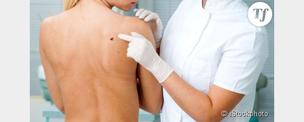 Cancer de la peau : les traitements progressent