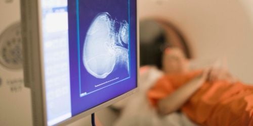 Scanner : un risque accru de cancer du cerveau pour les enfants