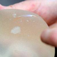 Implants mammaires PIP : des associations de victimes montent au créneau