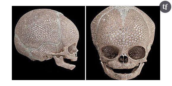 Damien Hirst : polémique autour d’un crâne d’enfant