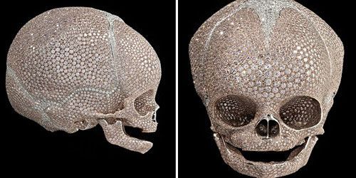 Damien Hirst : polémique autour d’un crâne d’enfant