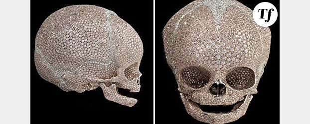 Damien Hirst : polémique autour d’un crâne d’enfant