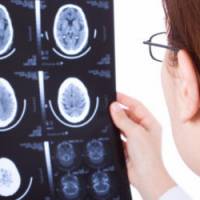 La France pratique trop d'actes médicaux injustifiés