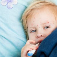 Varicelle : l'épidémie ralentit