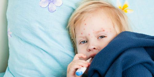 Varicelle : l'épidémie ralentit