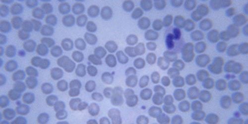 Asie : apparition d'une maladie infectieuse inconnue