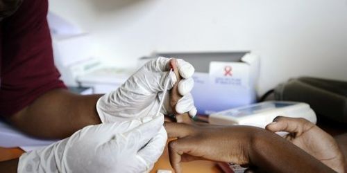 Dépistage du SIDA : quand, comment et où ? 