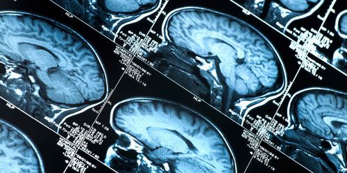 Un simple scanner peut-il détecter le racisme ?