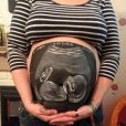 Inception : Une échographie SUR un ventre de femme enceinte