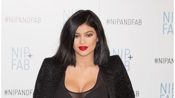 Kylie Jenner : elle admet enfin que ses lèvres sont fausses