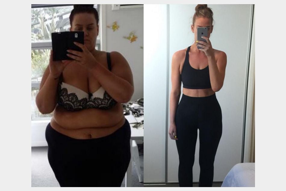 Simone Anderson avant et après sa perte de poids.