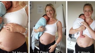 Elle partage les photos de son ventre post-grossesse pour rassurer les autres femmes