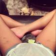 Il y a quelques mois, la mannequin Chrissy Teigen avait elle aussi affiché ses vergetures sur Instagram.