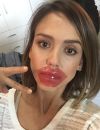 Sur Instagram, Jessica Alba s'affiche avec son lip patch !