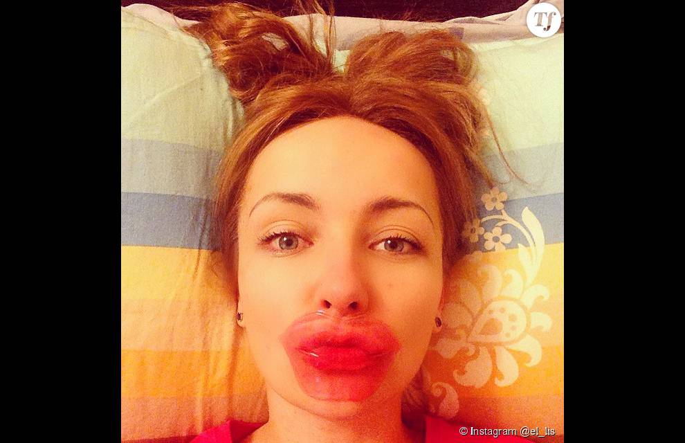 Le selfie #lippatch est un must sur Instagram.