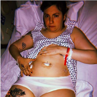 Le coup de gueule de Lena Dunham après l'ablation de son ovaire