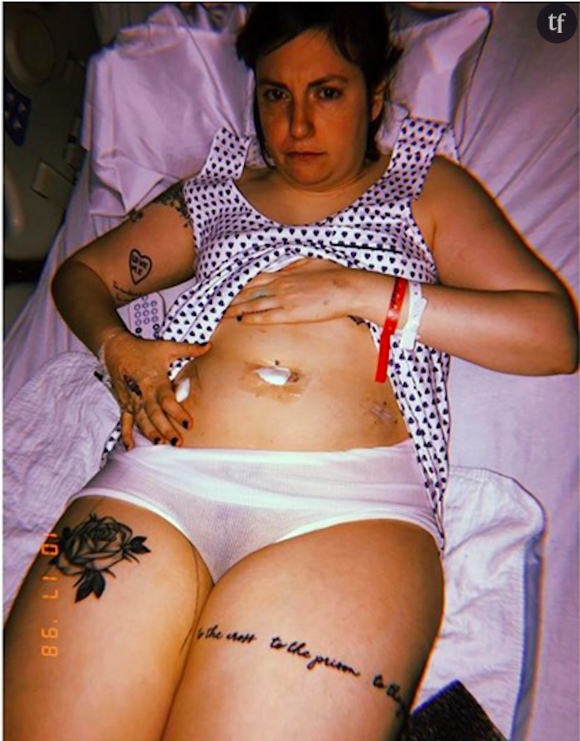 Après l'ablation de son ovaire gauche, Lena Dunham publie une photo d'elle sur son compte Instagram