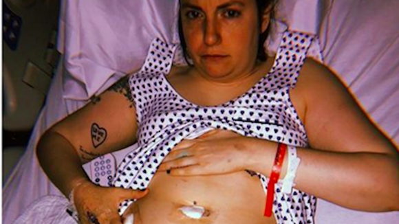 Le coup de gueule de Lena Dunham après l'ablation de son ovaire